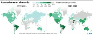 América Latina, la región con la mayor tasa de cesáreas del mundo - Mapa