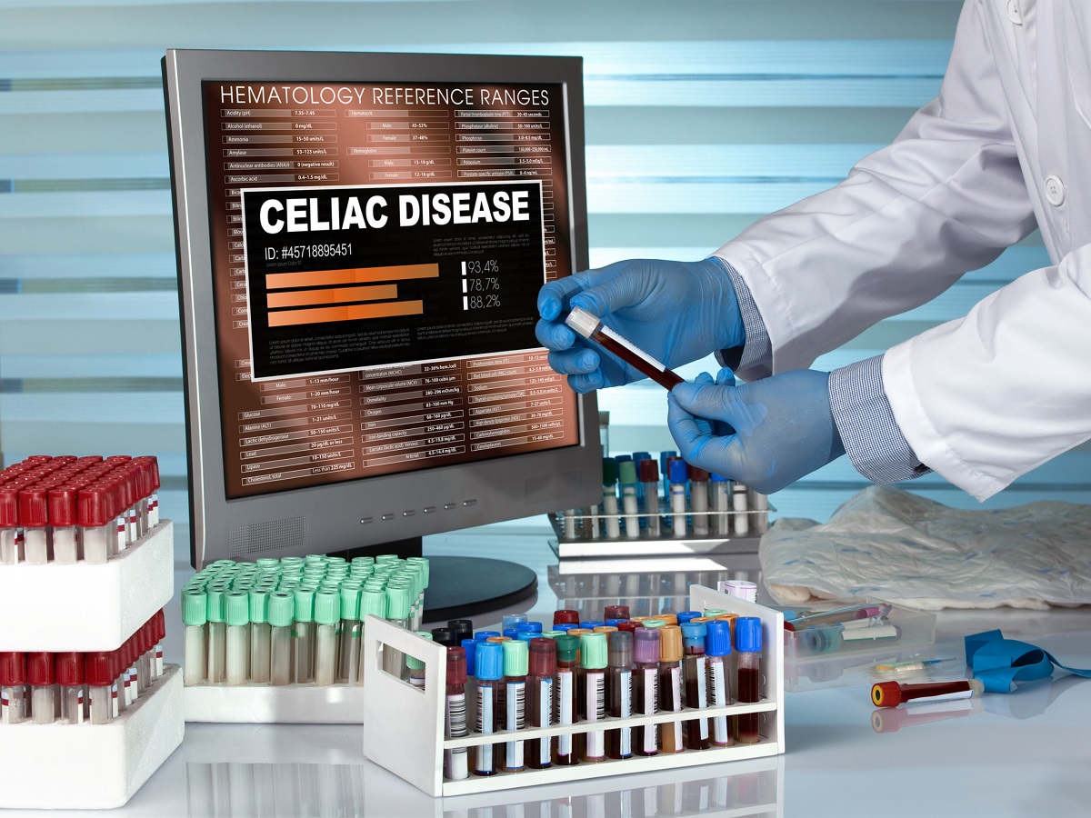 Estudio destaca los beneficios de la vacuna contra el COVID-19 para los celíacos
