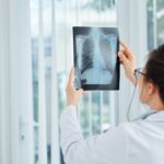 Importancia de los exámenes de detección de cáncer de pulmón