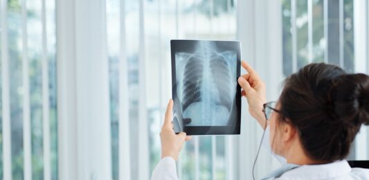 Importancia de los exámenes de detección de cáncer de pulmón