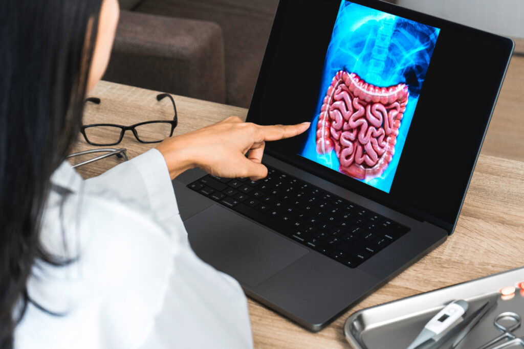 Nueva herramienta para detectar el cáncer colorrectal en jóvenes antes de los 45 años