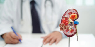 Nefritis lúpica una amenaza silenciosa que afecta al 47 % de los pacientes con lupus