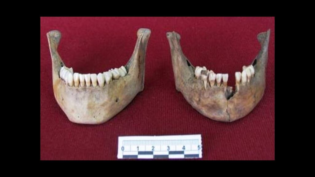 Antropología dental revela diversidad y sacrificios infantiles en el Chultún de Chichén Itzá 