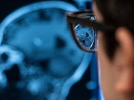 Los cambios en la forma del cerebro predicen el deterioro cognitivo, según un nuevo estudio