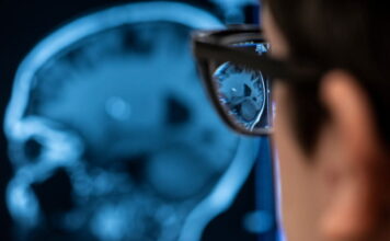 Los cambios en la forma del cerebro predicen el deterioro cognitivo, según un nuevo estudio