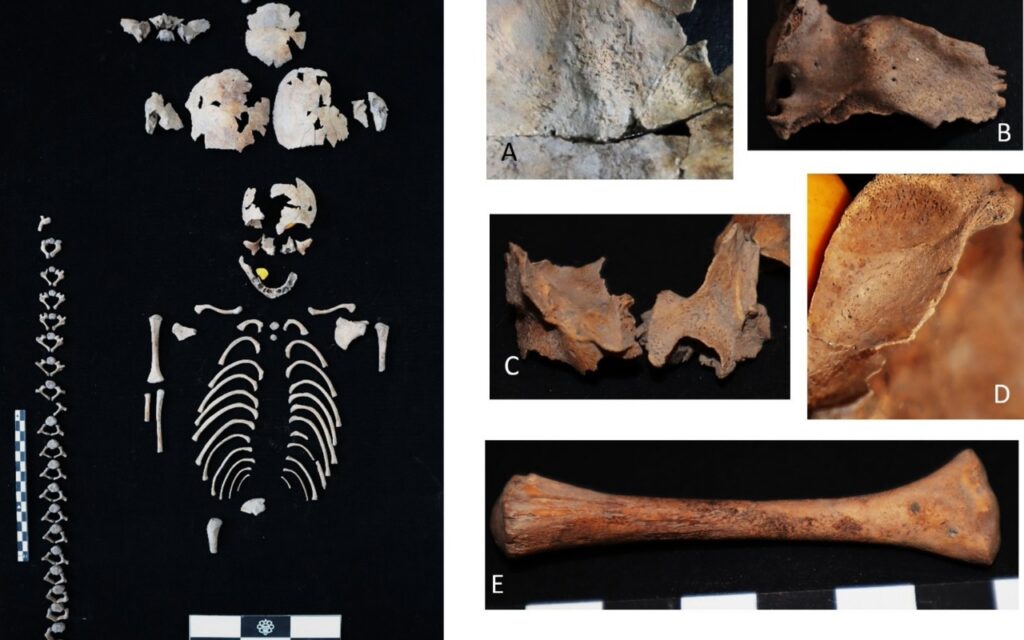 El hallazgo que revela muertes de mujeres durante parto y cólera en Tlatelolco