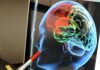 Conocer las señales de un derrame cerebral puede salvar una vida cuando cada minuto cuenta Conocer las señales de un derrame cerebral puede salvar una vida cuando cada minuto cuenta
