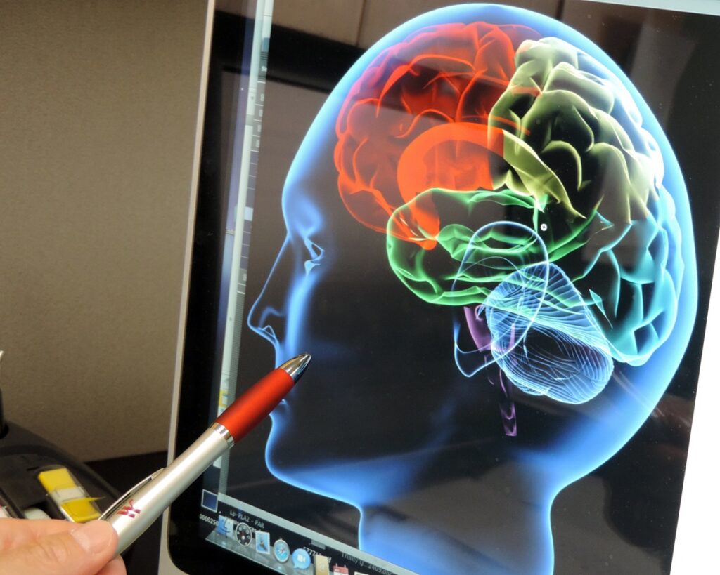 Conocer las señales de un derrame cerebral puede salvar una vida cuando cada minuto cuenta