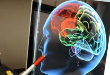 Conocer las señales de un derrame cerebral puede salvar una vida cuando cada minuto cuenta Conocer las señales de un derrame cerebral puede salvar una vida cuando cada minuto cuenta