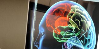 Conocer las señales de un derrame cerebral puede salvar una vida cuando cada minuto cuenta Conocer las señales de un derrame cerebral puede salvar una vida cuando cada minuto cuenta