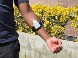 UC Irvine crea un parche inteligente que monitorea la salud a través del sudor UC Irvine crea un parche inteligente que monitorea la salud a través del sudor