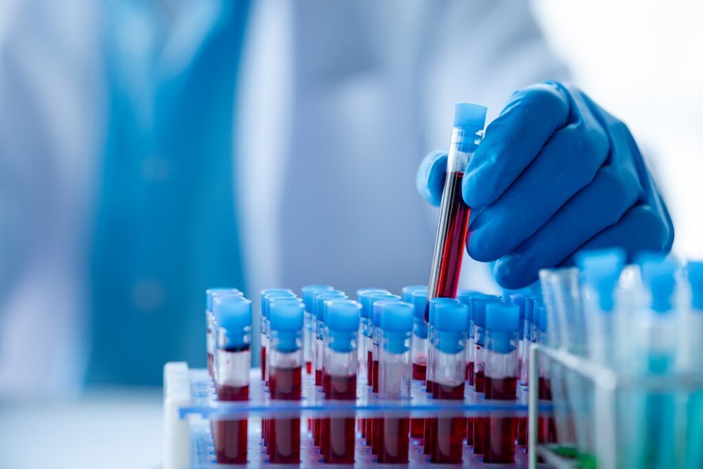 FDA aprueba la terapia celular Tregzi para pacientes con cáncer de sangre
