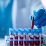 FDA aprueba la terapia celular Tregzi para pacientes con cáncer de sangre
