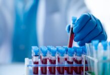 FDA aprueba la terapia celular Tregzi para pacientes con cáncer de sangre FDA aprueba la terapia celular Tregzi para pacientes con cáncer de sangre