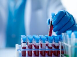 FDA aprueba la terapia celular Tregzi para pacientes con cáncer de sangre FDA aprueba la terapia celular Tregzi para pacientes con cáncer de sangre