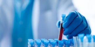 FDA aprueba la terapia celular Tregzi para pacientes con cáncer de sangre FDA aprueba la terapia celular Tregzi para pacientes con cáncer de sangre