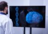 Daño vascular y amiloide convergen en un patrón común de Alzheimer Daño vascular y amiloide convergen en un patrón común de Alzheimer