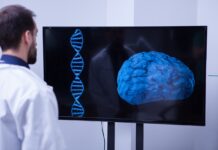 Daño vascular y amiloide convergen en un patrón común de Alzheimer Daño vascular y amiloide convergen en un patrón común de Alzheimer