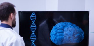 Daño vascular y amiloide convergen en un patrón común de Alzheimer Daño vascular y amiloide convergen en un patrón común de Alzheimer
