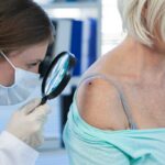 La FDA aprueba inmunoterapia viral para melanoma avanzado