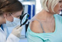 La FDA aprueba inmunoterapia viral para melanoma avanzado La FDA aprueba inmunoterapia viral para melanoma avanzado