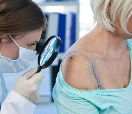 La FDA aprueba inmunoterapia viral para melanoma avanzado La FDA aprueba inmunoterapia viral para melanoma avanzado