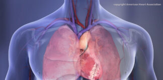 Enfermedades del corazón superan al cáncer entre latinos en Estados Unidos Enfermedades del corazón superan al cáncer entre latinos
