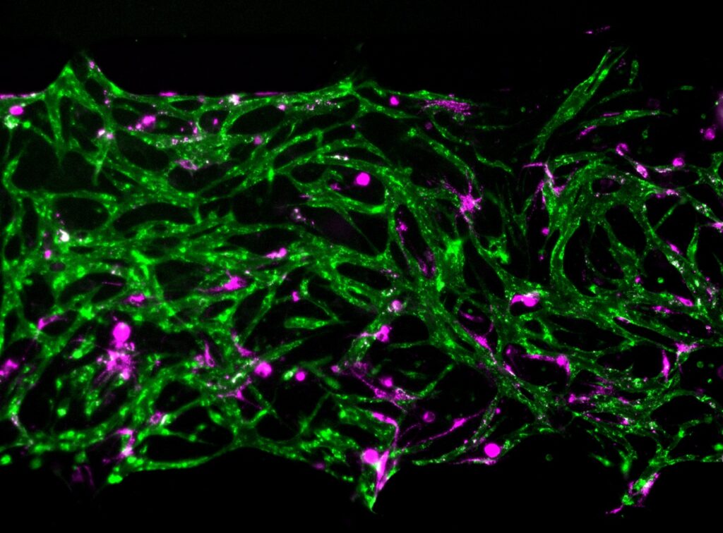 Modelo de médula ósea revela cómo sobreviven células inmunes