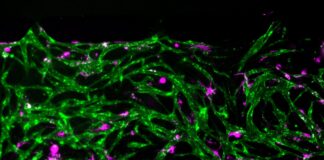 Modelo de médula ósea revela cómo sobreviven células inmunes Modelo de médula ósea revela cómo sobreviven células inmunes