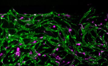 Modelo de médula ósea revela cómo sobreviven células inmunes Modelo de médula ósea revela cómo sobreviven células inmunes
