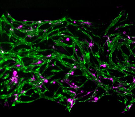 Modelo de médula ósea revela cómo sobreviven células inmunes Modelo de médula ósea revela cómo sobreviven células inmunes