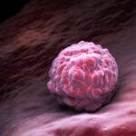 Anktiva obtiene una nueva indicación de la FDA para cáncer de vejiga