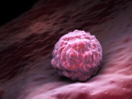 Anktiva obtiene una nueva indicación de la FDA para cáncer de vejiga Anktiva obtiene una nueva indicación de la FDA para cáncer de vejiga
