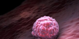 Anktiva obtiene una nueva indicación de la FDA para cáncer de vejiga Anktiva obtiene una nueva indicación de la FDA para cáncer de vejiga