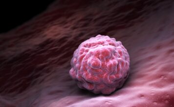 Anktiva obtiene una nueva indicación de la FDA para cáncer de vejiga Anktiva obtiene una nueva indicación de la FDA para cáncer de vejiga