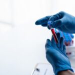 HHS amplía a siete regiones su red de atención de células falciformes