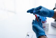 HHS amplía a siete regiones su red de atención de células falciformes HHS amplía a siete regiones su red de atención de células falciformes