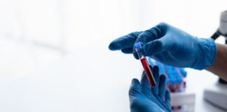 HHS amplía a siete regiones su red de atención de células falciformes HHS amplía a siete regiones su red de atención de células falciformes
