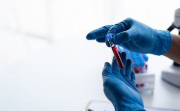 HHS amplía a siete regiones su red de atención de células falciformes HHS amplía a siete regiones su red de atención de células falciformes