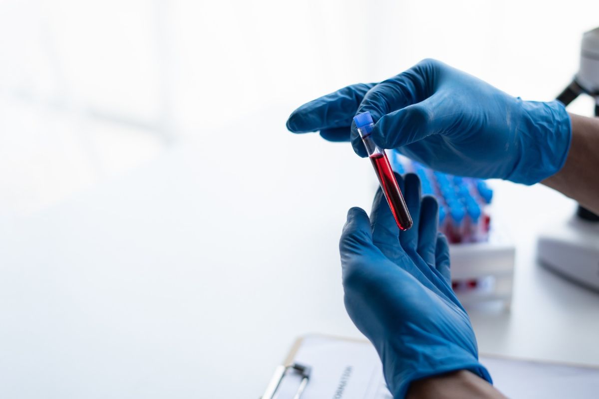 HHS amplía a siete regiones su red de atención de células falciformes HHS amplía a siete regiones su red de atención de células falciformes