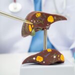 La FDA aprueba Hibsago para ciertos adultos con hepatitis B crónica