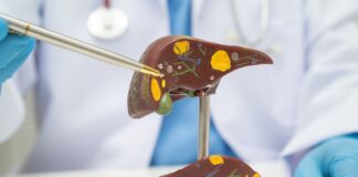 La FDA aprueba Hibsago para ciertos adultos con hepatitis B crónica La FDA aprueba Hibsago para ciertos adultos con hepatitis B crónica