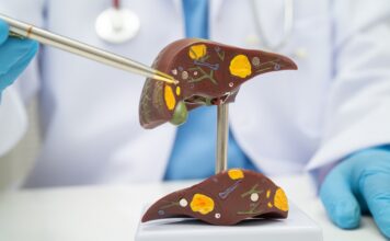 La FDA aprueba Hibsago para ciertos adultos con hepatitis B crónica La FDA aprueba Hibsago para ciertos adultos con hepatitis B crónica