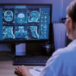 Un estudio con 13 pacientes reduce 80% las falsas alarmas de un monitor de epilepsia