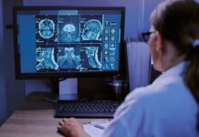 Un estudio con 13 pacientes reduce 80% las falsas alarmas de un monitor de epilepsia Un estudio con 13 pacientes reduce 80% las falsas alarmas de un monitor de epilepsia