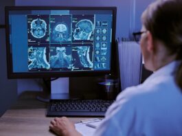 Un estudio con 13 pacientes reduce 80% las falsas alarmas de un monitor de epilepsia Un estudio con 13 pacientes reduce 80% las falsas alarmas de un monitor de epilepsia