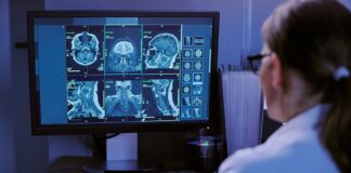 Un estudio con 13 pacientes reduce 80% las falsas alarmas de un monitor de epilepsia Un estudio con 13 pacientes reduce 80% las falsas alarmas de un monitor de epilepsia