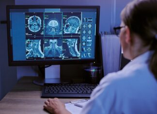 Un estudio con 13 pacientes reduce 80% las falsas alarmas de un monitor de epilepsia Un estudio con 13 pacientes reduce 80% las falsas alarmas de un monitor de epilepsia