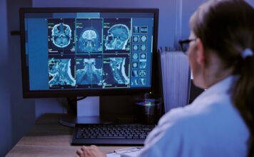 Un estudio con 13 pacientes reduce 80% las falsas alarmas de un monitor de epilepsia Un estudio con 13 pacientes reduce 80% las falsas alarmas de un monitor de epilepsia