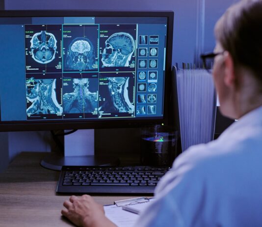 Un estudio con 13 pacientes reduce 80% las falsas alarmas de un monitor de epilepsia Un estudio con 13 pacientes reduce 80% las falsas alarmas de un monitor de epilepsia